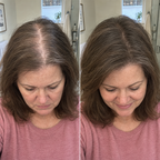 ⏳🔥LIMITED-TIME 83% OFF! ⏰Flat Roots? Get Soft, Airy Volume in Seconds💯