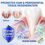 Periodontal Repair Gel